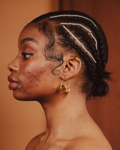 Saying no to melanophobia — affirming melanin-rich skin | MELA